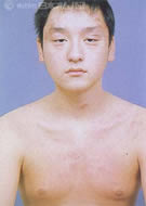 湯治経過日数０